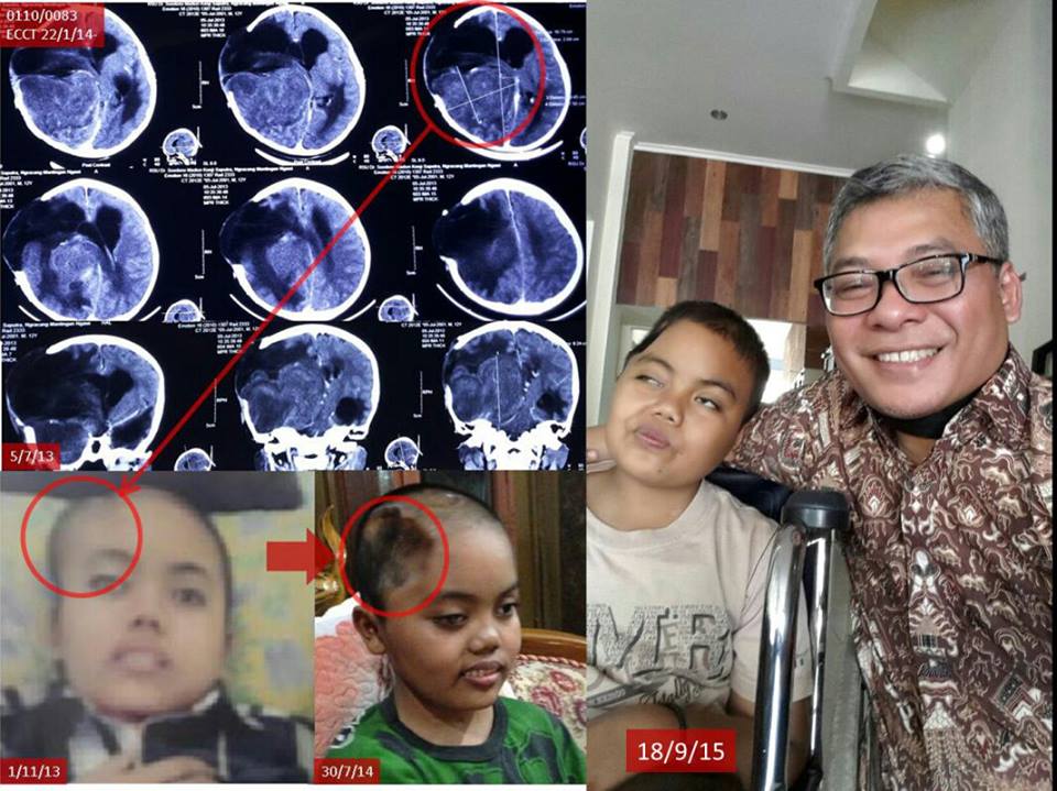 Alat terapi kankernya dilarang Kemenkes, Warsito latih medis Polandia