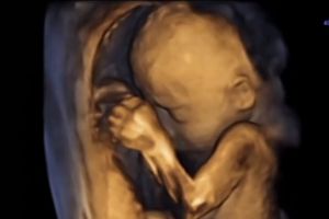 Ibu suka nonton gulat, bayi dalam perut tinju wajah sendiri, wah!