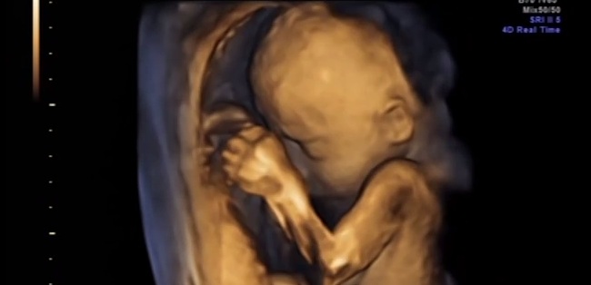 Ibu suka nonton gulat, bayi dalam perut tinju wajah sendiri, wah!