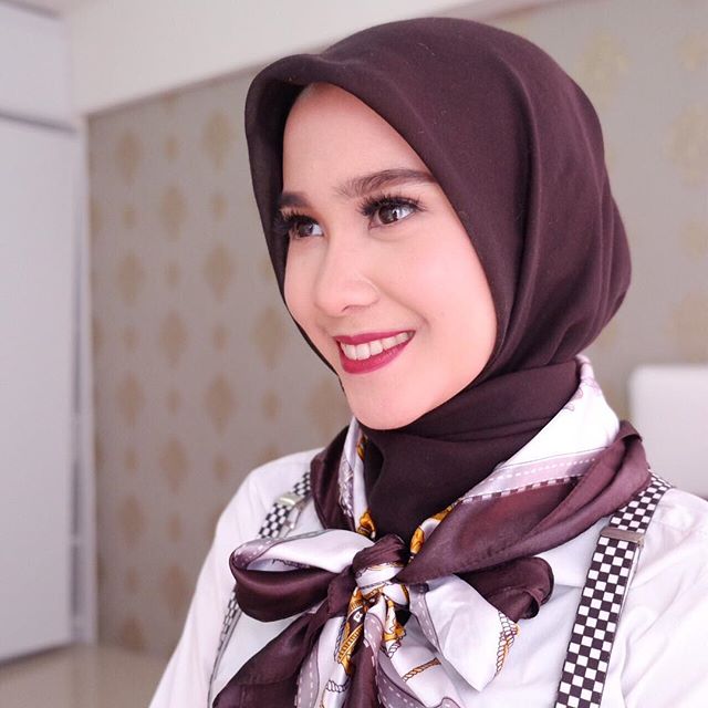 Kenalan yuk dengan Fildza, dokter gigi cantik kakaknya Iqbaal CJR