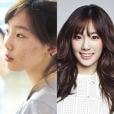 Terlalu sering pakai make up, wajah 10 idola K-Pop ini jerawatan, duh!