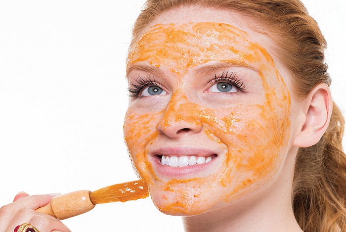 10 Cara mudah untuk mengatasi kulit terbakar matahari 