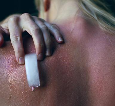 10 Cara mudah untuk mengatasi kulit terbakar matahari 