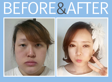 keajaiban oplas korea © 2016 brilio.net keajaiban oplas korea © 2016 brilio.net