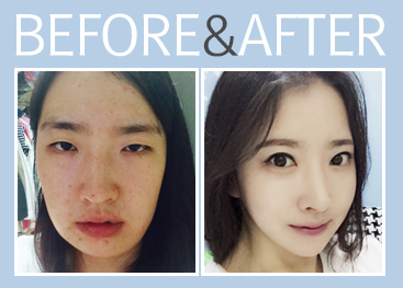 keajaiban oplas korea © 2016 brilio.net keajaiban oplas korea © 2016 brilio.net