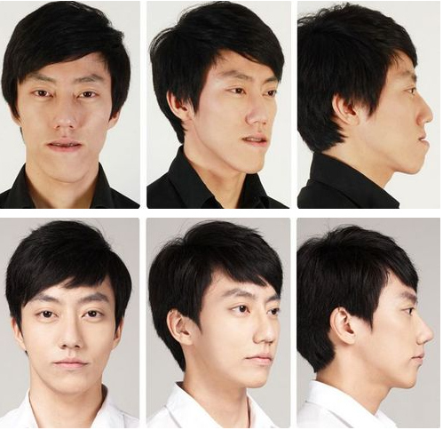 keajaiban oplas korea © 2016 brilio.net keajaiban oplas korea © 2016 brilio.net