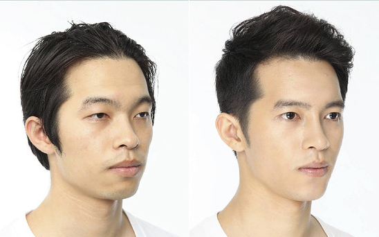 keajaiban oplas korea © 2016 brilio.net keajaiban oplas korea © 2016 brilio.net