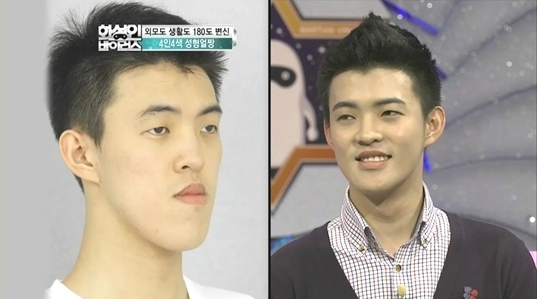 keajaiban oplas korea © 2016 brilio.net keajaiban oplas korea © 2016 brilio.net