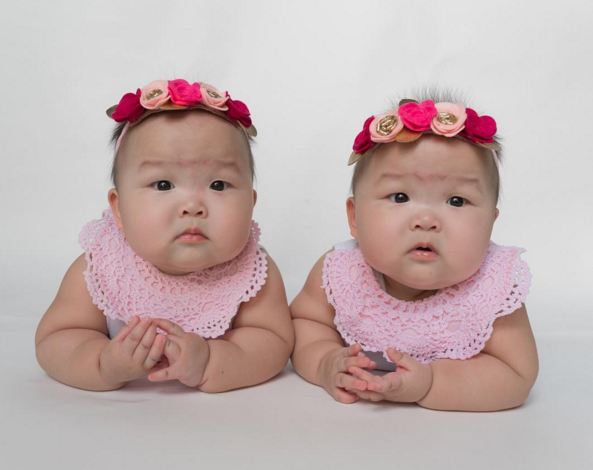 bayi kembar Leia & Lauren © 2016 brilio.net bayi kembar Leia & Lauren © 2016 brilio.net