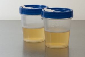 Ternyata urine bisa diubah jadi energi listrik lho, kok bisa ya?