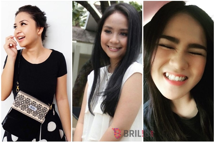 12 Artis bergigi gingsul manisnya bikin cowok gagal fokus! 