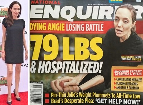 Mengidap anoreksia, penampilan Angelina Jolie kini memprihatinkan