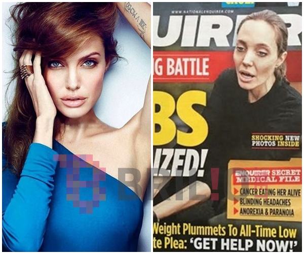 Mengidap anoreksia, penampilan Angelina Jolie kini memprihatinkan