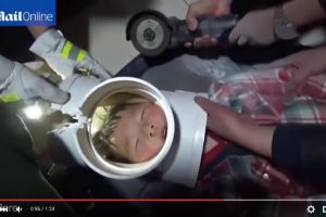 Kepala bocah ini masuk pralon dan sulit dikeluarkan, duh ngeri!