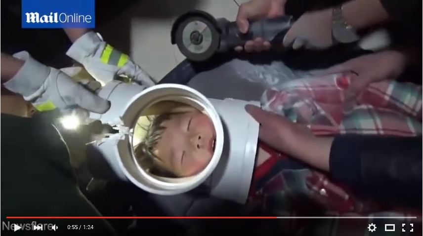 Kepala bocah ini masuk pralon dan sulit dikeluarkan, duh ngeri!