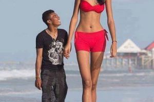 11 Foto ini buktikan cinta tak mengenal fisik, so sweet banget!