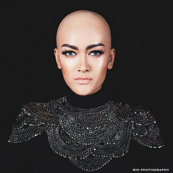 artis kanker © 2016 brilio.net