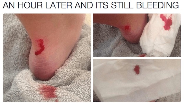 20 Masalah cewek © 2016 brilio.net