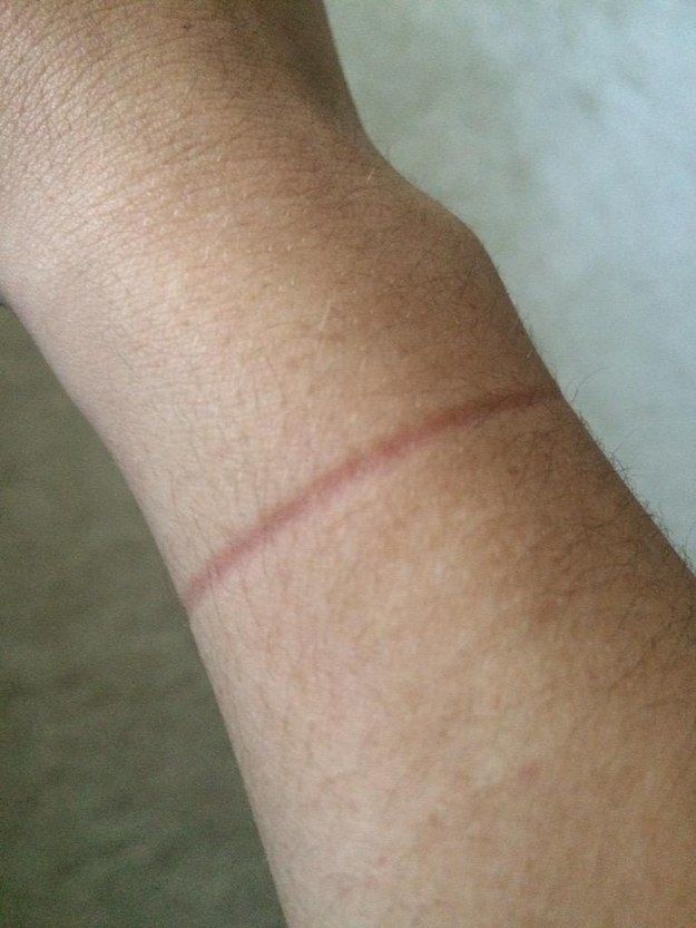 20 Masalah cewek © 2016 brilio.net