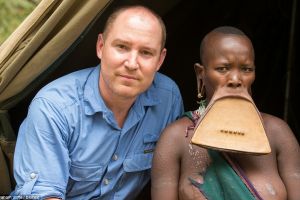 Bibir wanita ini sanggup melar selebar piringan hampir 20 cm, ekstrem!