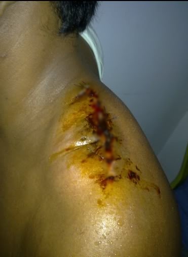 Luka Ngeri 2 © 2016 brilio.net