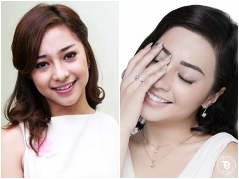 artis permak gigi © 2016 brilio.net