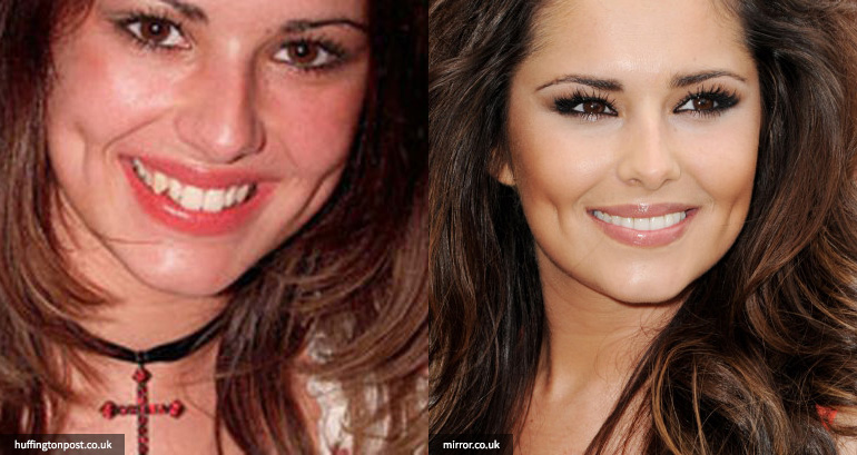 artis permak gigi © 2016 brilio.net