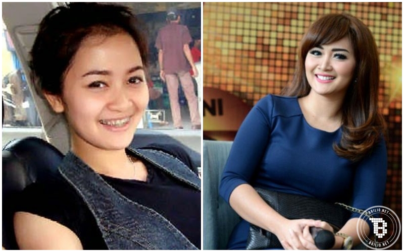 artis permak gigi © 2016 brilio.net