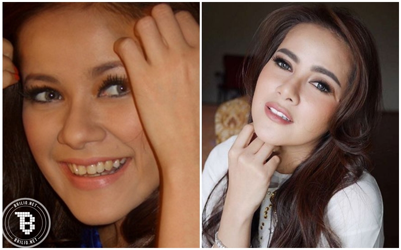 artis permak gigi © 2016 brilio.net