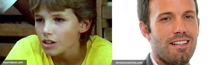 artis permak gigi © 2016 brilio.net