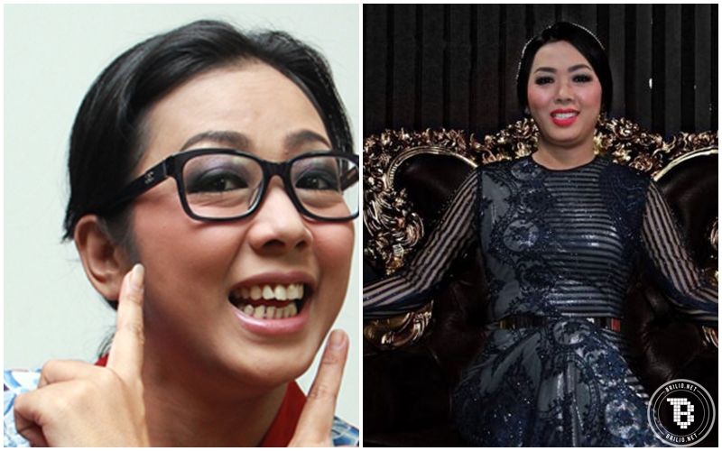 artis permak gigi © 2016 brilio.net