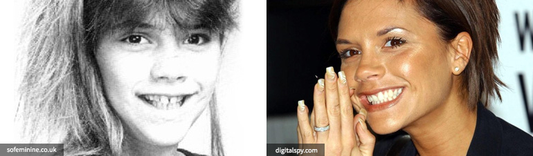 artis permak gigi © 2016 brilio.net