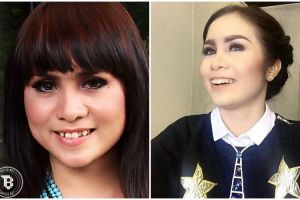 15 Artis dengan senyum menawan ini ternyata pernah permak gigi lho