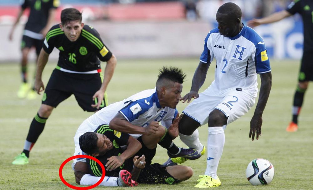 Patah Bola © 2016 brilio.net