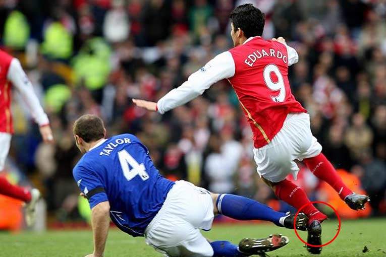 Patah Bola © 2016 brilio.net