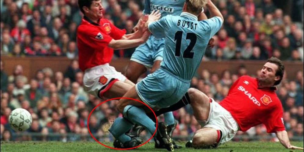 Patah Bola © 2016 brilio.net