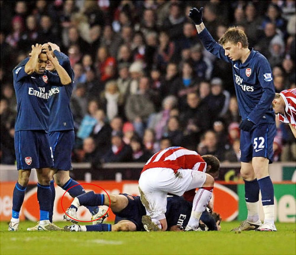 Patah Bola © 2016 brilio.net