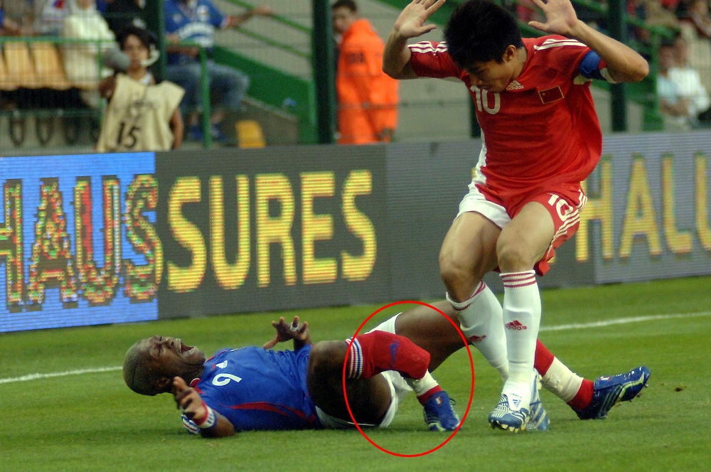 Patah Bola © 2016 brilio.net