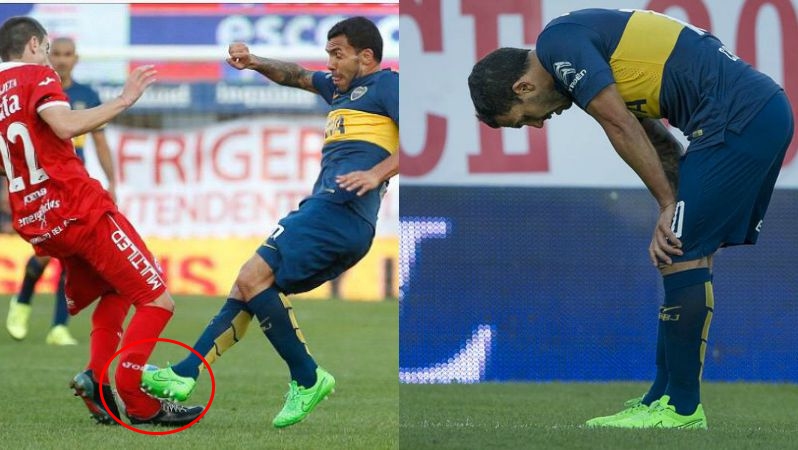 Patah Bola © 2016 brilio.net