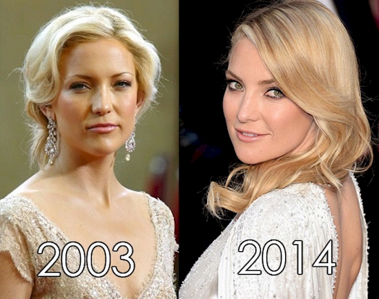 artis awet muda © 2016 brilio.net artis awet muda © 2016 brilio.net