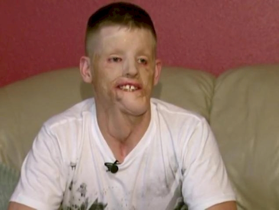 transformasi wajah hunter © 2016 brilio.net transformasi wajah hunter © 2016 brilio.net