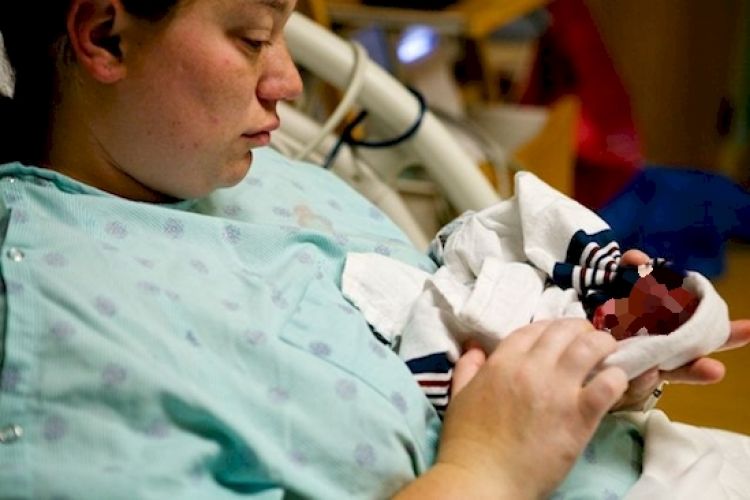 19 Minggu Usia Kehamilan Wanita Ini Melahirkan Bayi Yang Bikin H