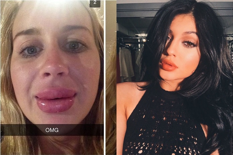 20 kesialan © 2016 brilio.net