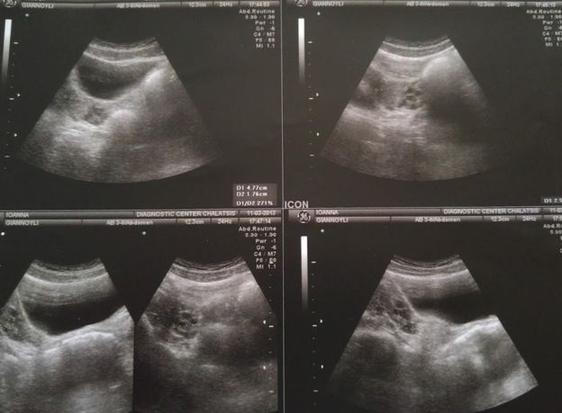  joanna giannouli © 2016 brilio.net