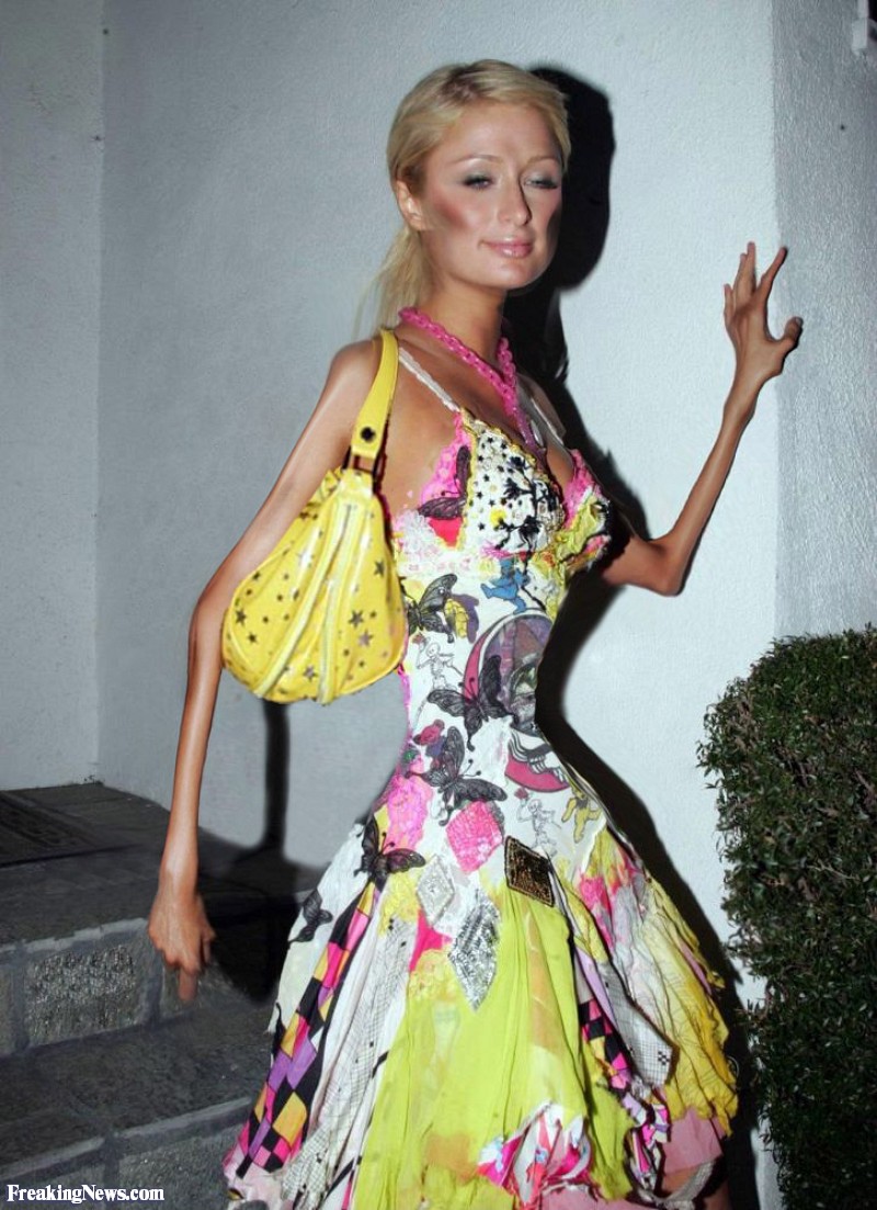 seleb anoreksia © 2016 brilio.net