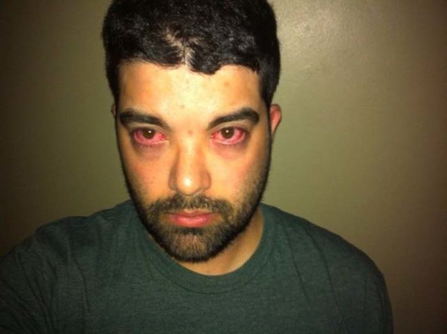 reaksi alergi © 2016 brilio.net reaksi alergi © 2016 brilio.net