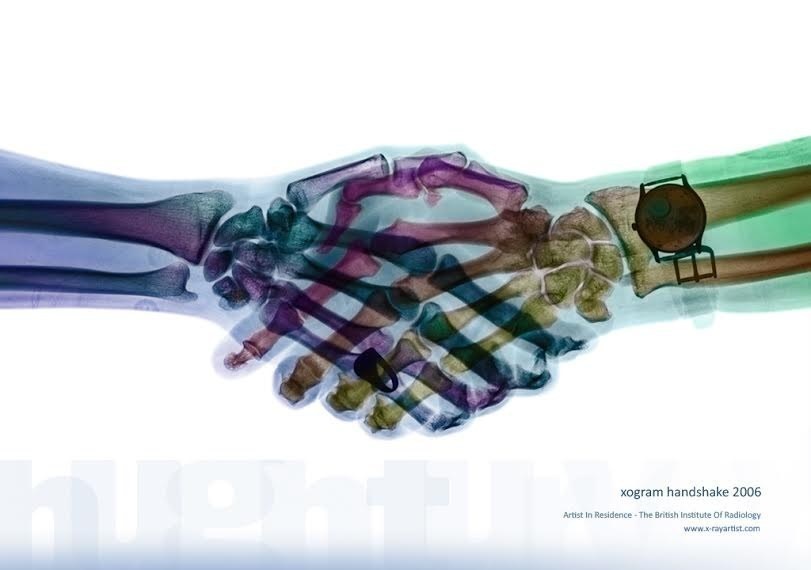 foto hasil sinar rontgent © 2016 brilio.net