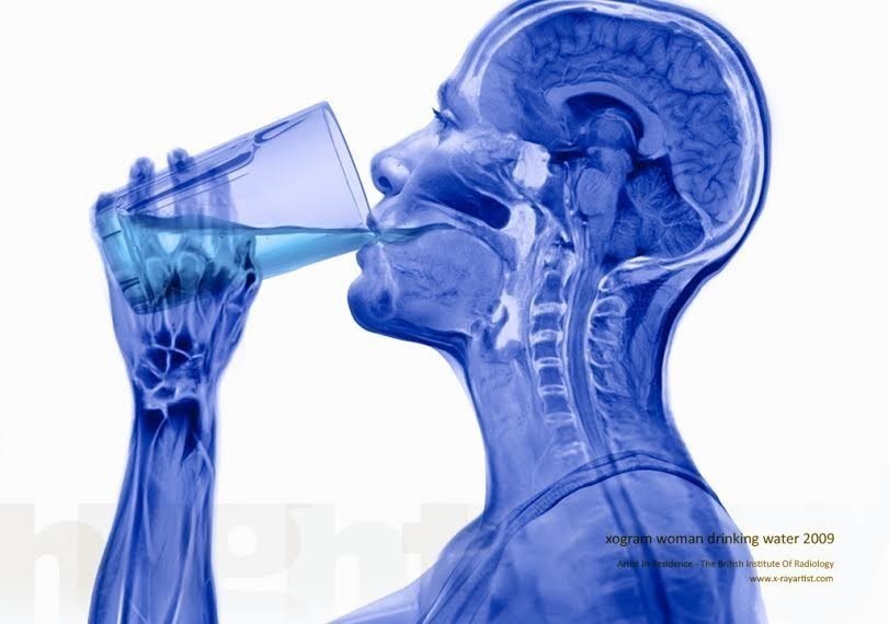 foto hasil sinar rontgent © 2016 brilio.net