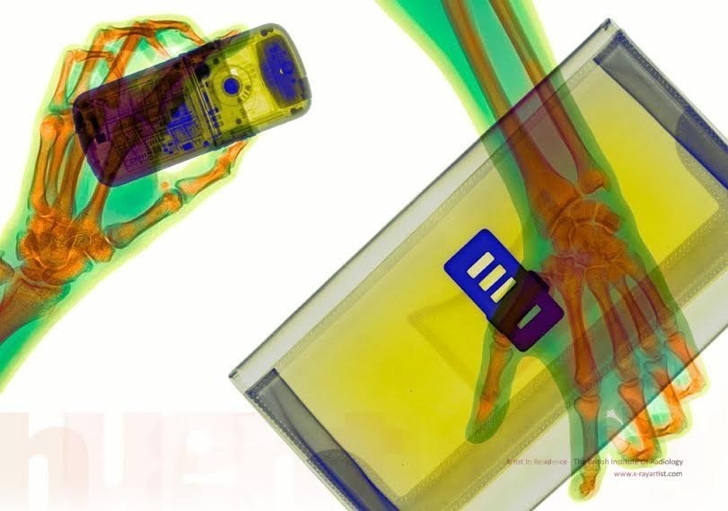 foto hasil sinar rontgent © 2016 brilio.net