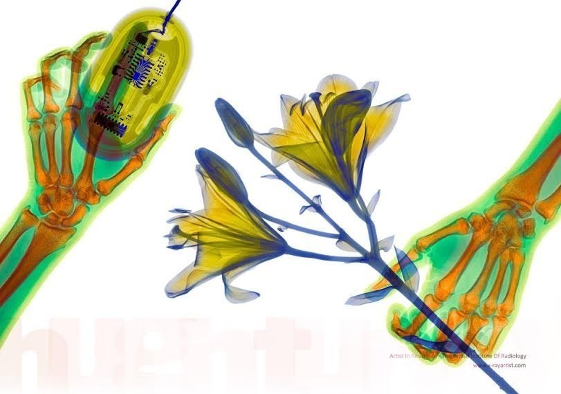 foto hasil sinar rontgent © 2016 brilio.net